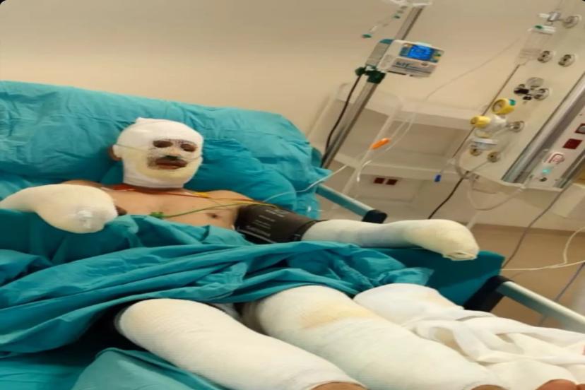 Kader Dereli Yanık Ünitesinde: Görev Başında Alevlerin İçinde Kaldı